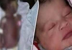 تفحم طفلة داخل حضانة مستشفى بمدينة نصر ووالدها يتهم الأطباء بالتسبب فى وفاتها